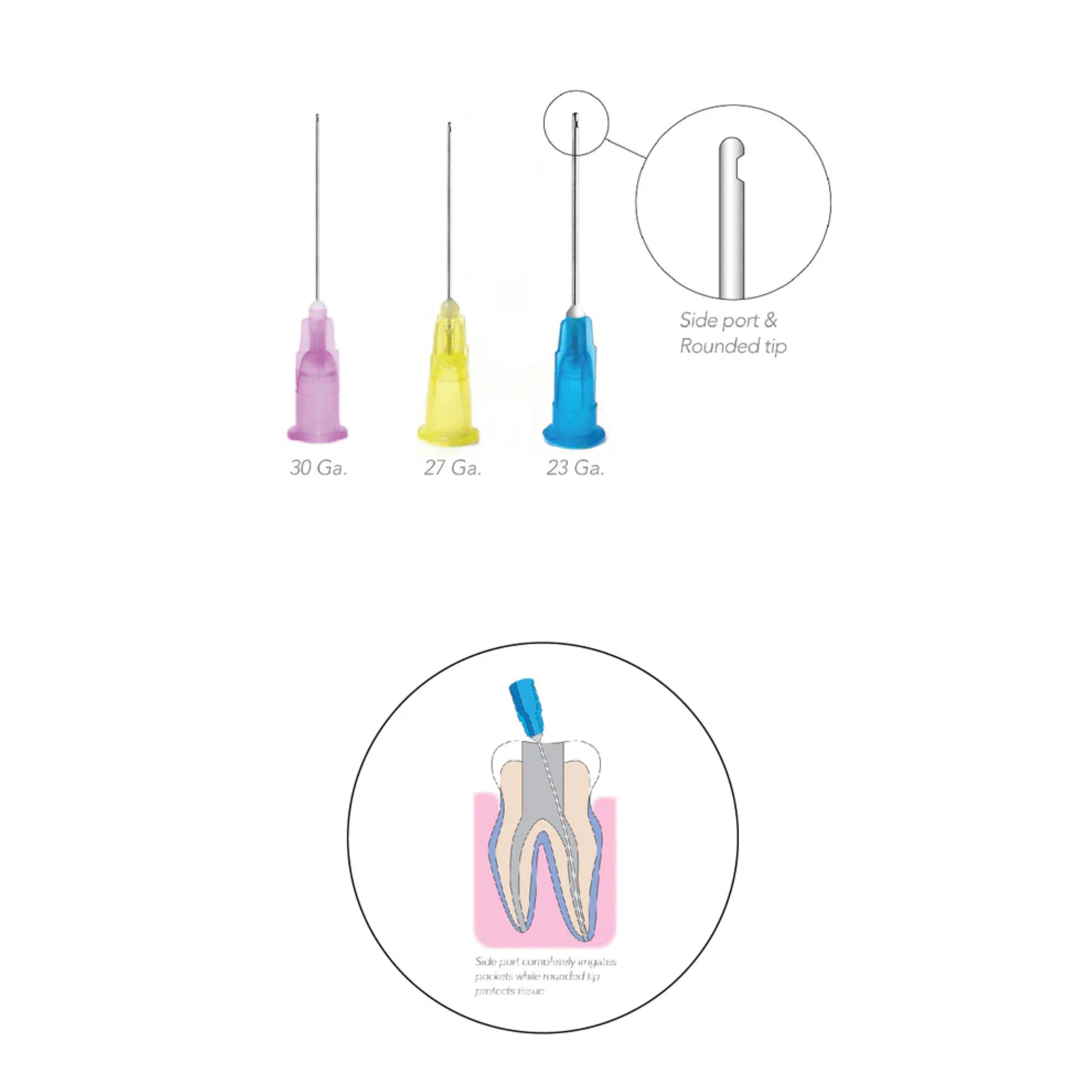 OptiProbe, Endo Irrigation Needles, Side-Vent, 30 Ga, Purple, 100/Pk, 226