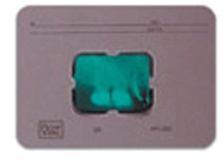 Greylight X-Ray Mounts 100/Pk 20-12H 