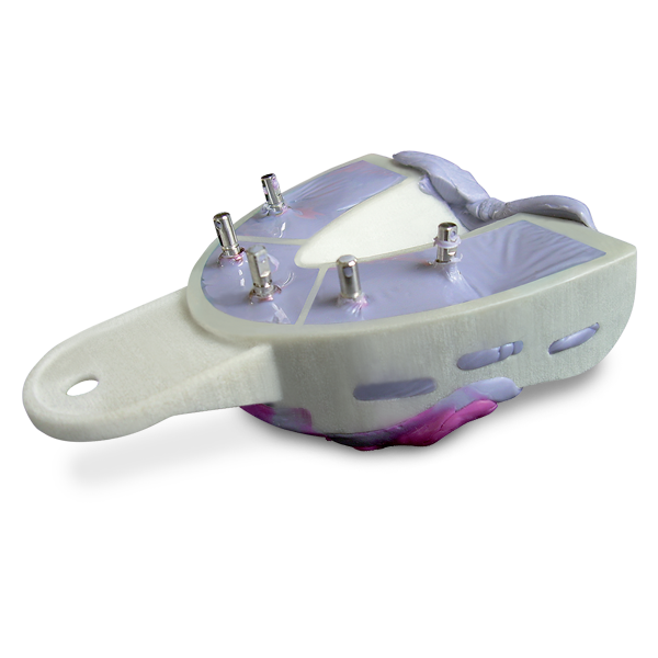 Miratray Implant Advanced Impression Trays, Intro Kit, 6/Pk